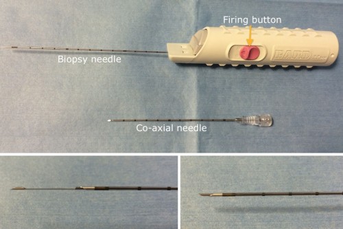 This is the most commonly used biopsy gun in our department. It is often used in tandem with a co-axial needle (top image) which can be advanced into the organ/lesion first, before advancing the biopsy needle. There are two components to the biopsy needle. When the gun is 'fired', an inner component springs forward first - this has a shelf that allows tissue into it (bottom left image). The outer component of the needle automatically advances over the inner needle, trapping that tissue sample in the shelf.