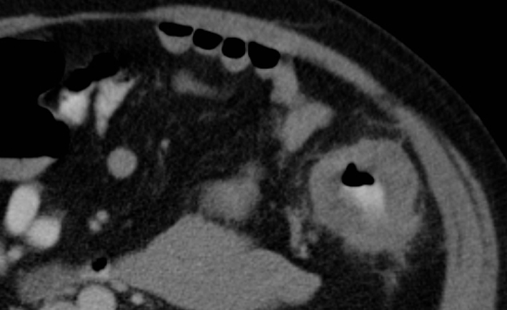 Interventional Radiology Program