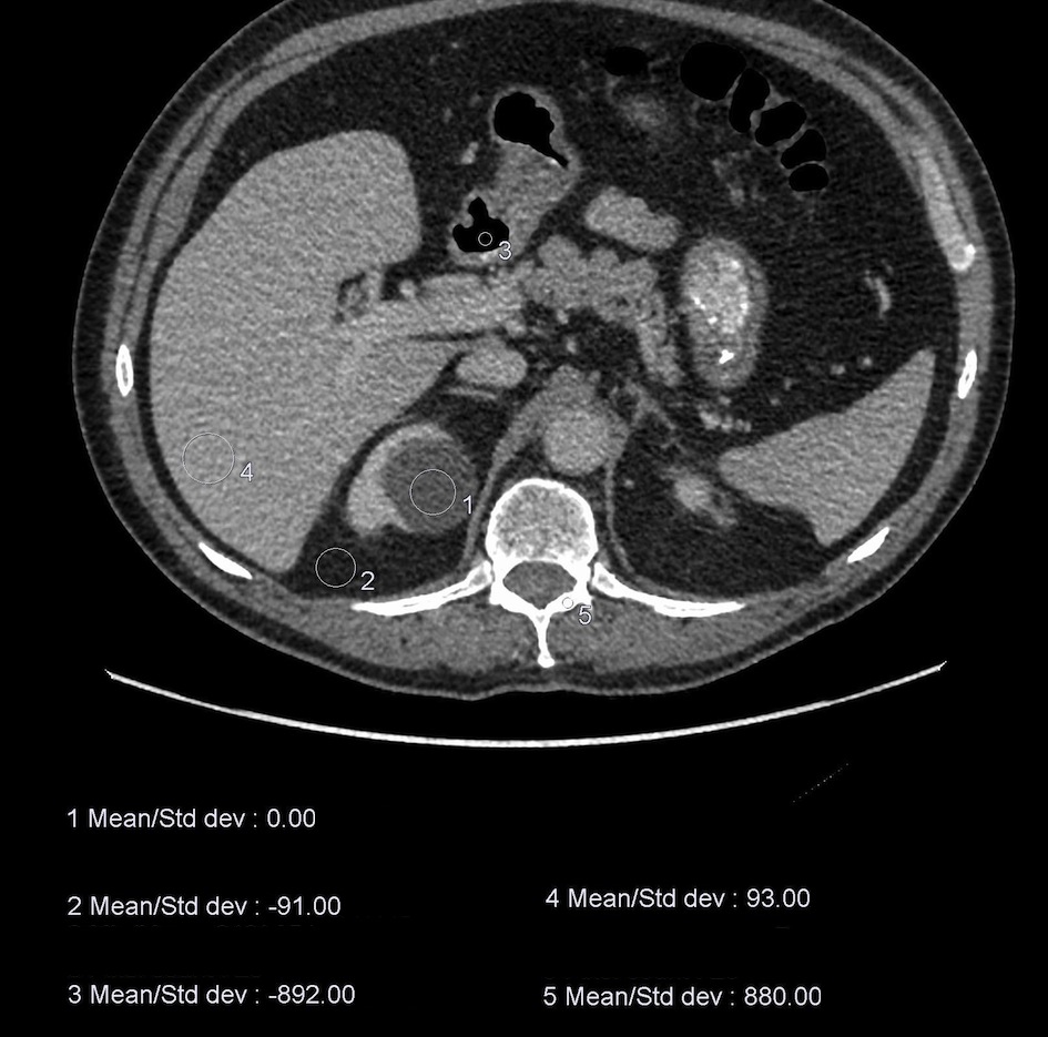 CT - Radiology at St. Vincent's University Hospital