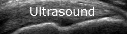 UltrasoundNew