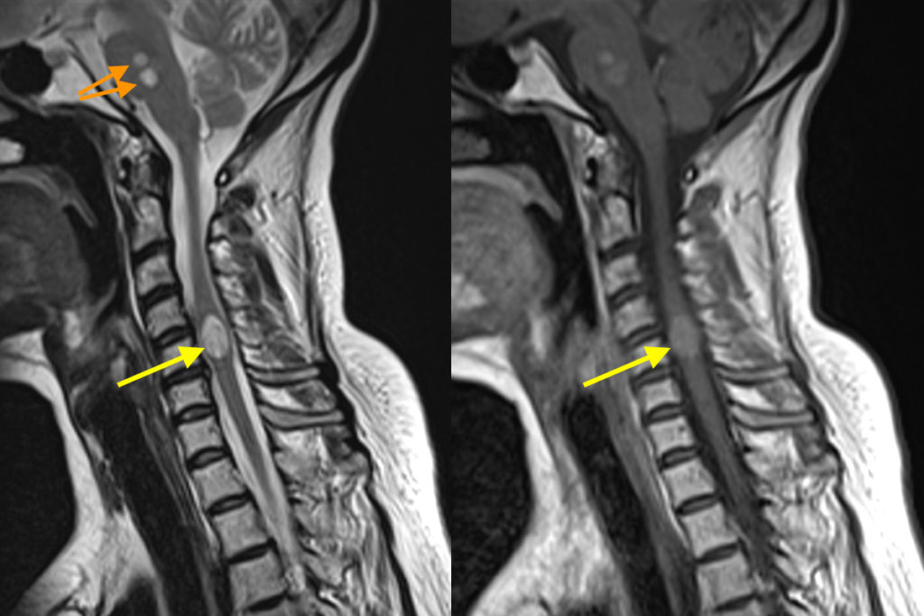 Anatomy Of Vertebral Bone